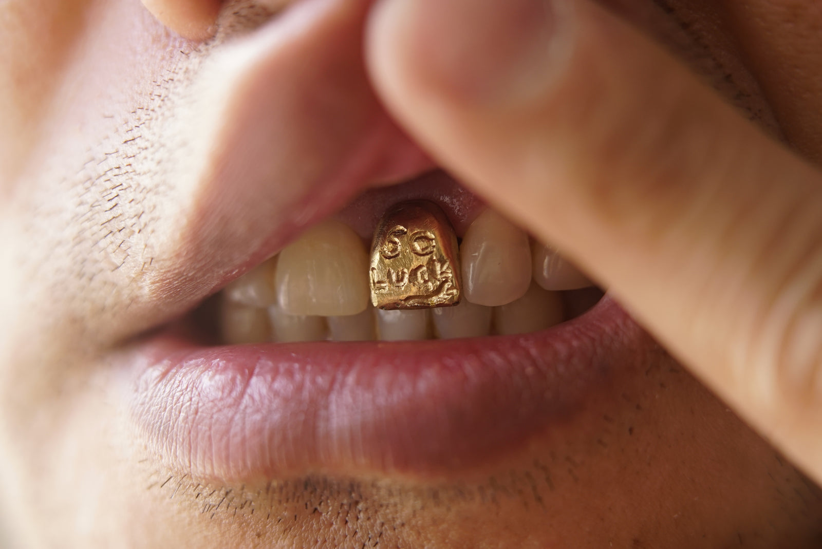 Tooth Gallery